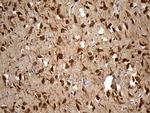 EEF1D Antibody in Immunohistochemistry (Paraffin) (IHC (P))