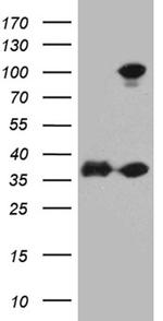 EEF1D Antibody in Western Blot (WB)