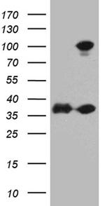 EEF1D Antibody in Western Blot (WB)