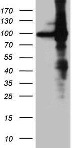 EEF1D Antibody in Western Blot (WB)