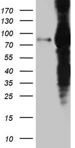 EEF1D Antibody in Western Blot (WB)