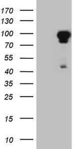 EEF1D Antibody in Western Blot (WB)