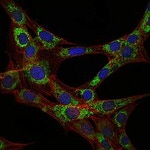 EEF2 Antibody in Immunocytochemistry (ICC/IF)