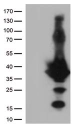 EFHD1 Antibody in Western Blot (WB)