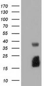 EFNA2 Antibody in Western Blot (WB)