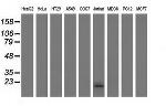 EFNA2 Antibody in Western Blot (WB)