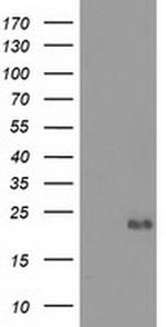 EFNA2 Antibody in Western Blot (WB)