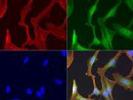 EGFR Antibody in Immunocytochemistry (ICC/IF)