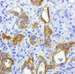 EGFR Antibody in Immunohistochemistry (Paraffin) (IHC (P))