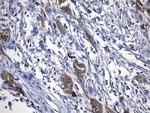 EGFR L858R Antibody in Immunohistochemistry (Paraffin) (IHC (P))