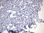 EGFR L858R Antibody in Immunohistochemistry (Paraffin) (IHC (P))