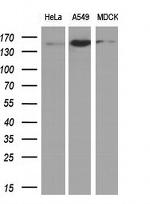 EGFR Antibody in Western Blot (WB)