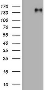 EGFR Antibody in Western Blot (WB)