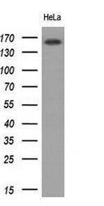 EGFR Antibody in Western Blot (WB)