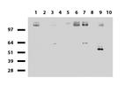 EGFR Antibody in Western Blot (WB)