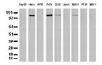 EGFR Antibody in Western Blot (WB)