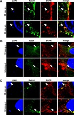 EGFR Antibody in Immunocytochemistry (ICC/IF)