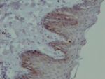 EGFR Antibody in Immunohistochemistry (Paraffin) (IHC (P))