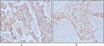 EGF Antibody in Immunohistochemistry (Paraffin) (IHC (P))