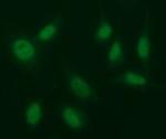 EGR2 Antibody in Immunocytochemistry (ICC/IF)