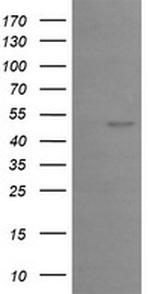 EGR2 Antibody in Western Blot (WB)