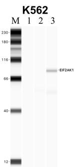 HRI Antibody in Immunoprecipitation (IP)