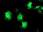 EIF2B3 Antibody in Immunocytochemistry (ICC/IF)