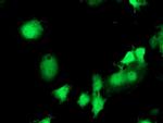 EIF2B3 Antibody in Immunocytochemistry (ICC/IF)