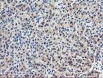 EIF2B3 Antibody in Immunohistochemistry (Paraffin) (IHC (P))