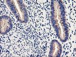 EIF2B3 Antibody in Immunohistochemistry (Paraffin) (IHC (P))