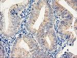 EIF2B3 Antibody in Immunohistochemistry (Paraffin) (IHC (P))