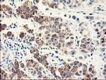 EIF2B3 Antibody in Immunohistochemistry (Paraffin) (IHC (P))