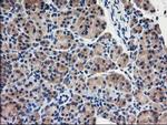 EIF2B3 Antibody in Immunohistochemistry (Paraffin) (IHC (P))