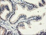 EIF2B3 Antibody in Immunohistochemistry (Paraffin) (IHC (P))