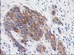 EIF2B3 Antibody in Immunohistochemistry (Paraffin) (IHC (P))