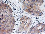 EIF2B3 Antibody in Immunohistochemistry (Paraffin) (IHC (P))