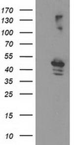 EIF2B3 Antibody in Western Blot (WB)