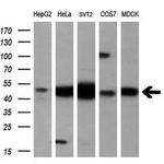 EIF2B3 Antibody in Western Blot (WB)