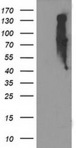 EIF2B3 Antibody in Western Blot (WB)