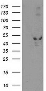 EIF2B3 Antibody in Western Blot (WB)