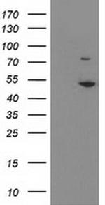 EIF2B3 Antibody in Western Blot (WB)