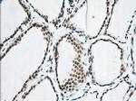 EIF2S1 Antibody in Immunohistochemistry (Paraffin) (IHC (P))