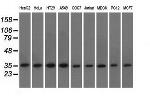 EIF2S1 Antibody in Western Blot (WB)