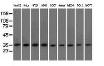 EIF2S1 Antibody in Western Blot (WB)