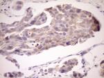 EIF3D Antibody in Immunohistochemistry (Paraffin) (IHC (P))