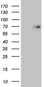 EIF3D Antibody in Western Blot (WB)