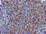 EIF4E Antibody in Immunohistochemistry (Paraffin) (IHC (P))