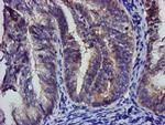 EIF4E Antibody in Immunohistochemistry (Paraffin) (IHC (P))