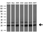 EIF4E Antibody in Western Blot (WB)