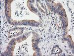 EIF4E2 Antibody in Immunohistochemistry (Paraffin) (IHC (P))